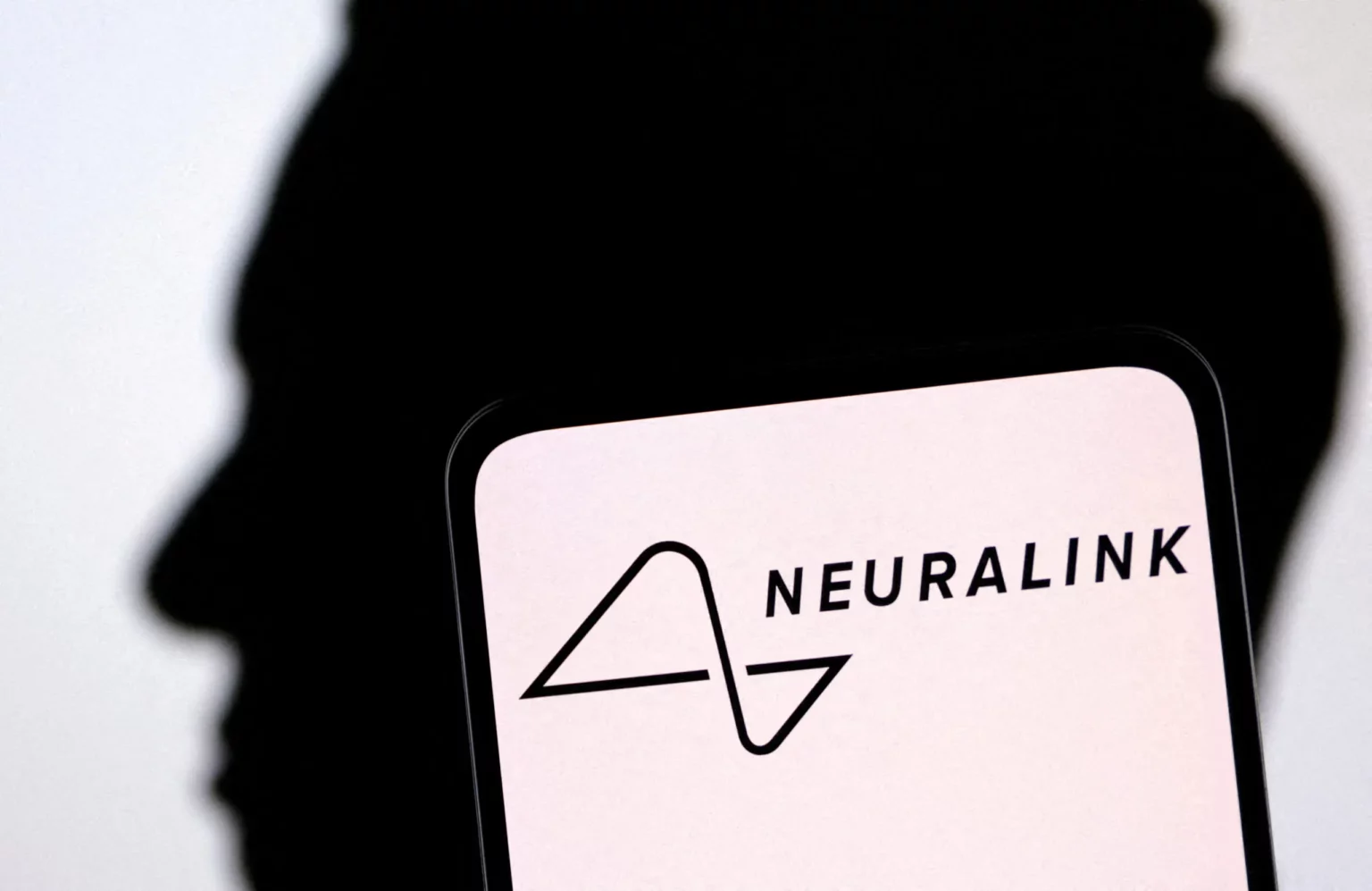 Neuralink's Wire Troubles Known Before Human Trials Began