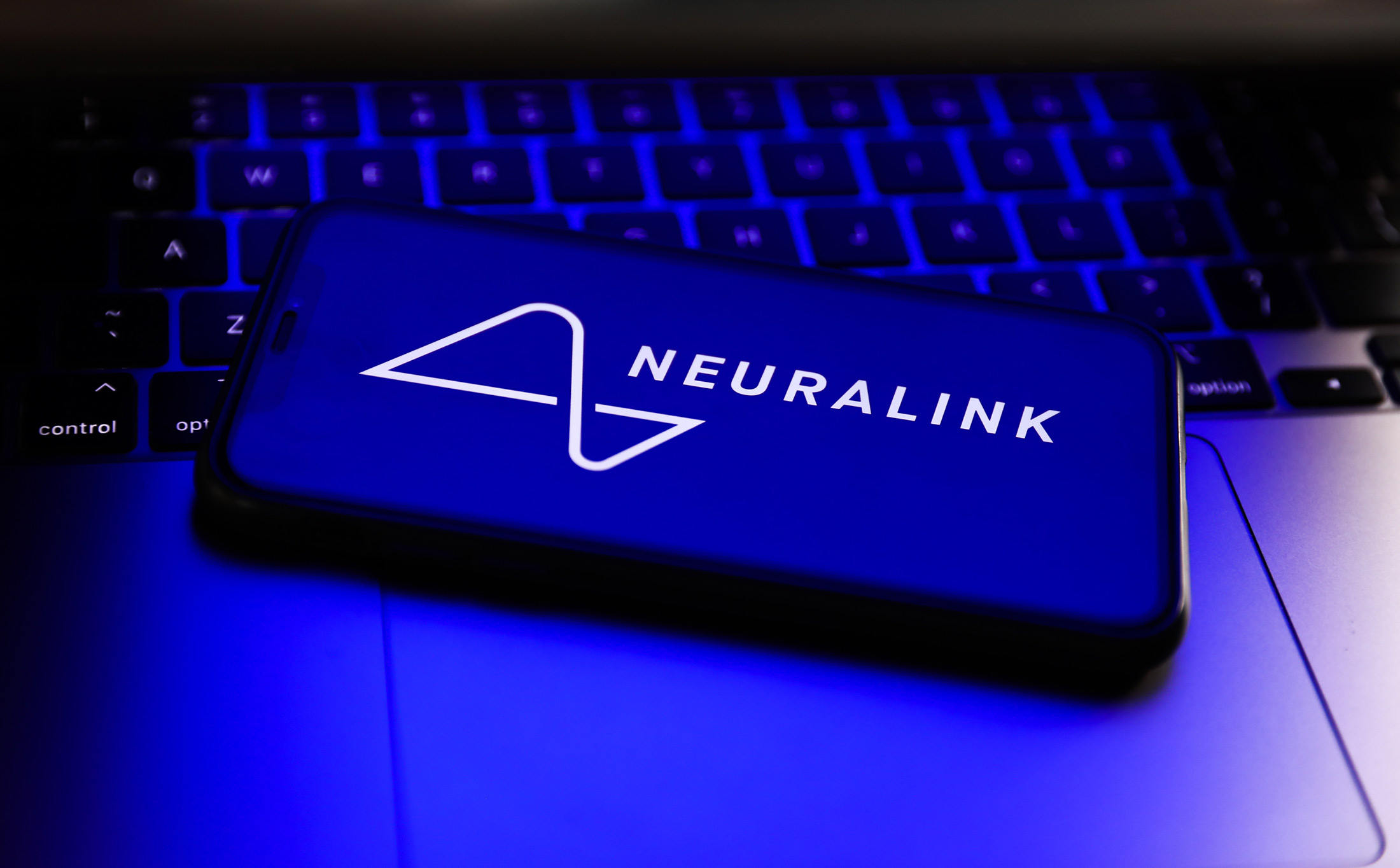 Neuralink’s Human Implant Trial Encounters Unexpected Issues