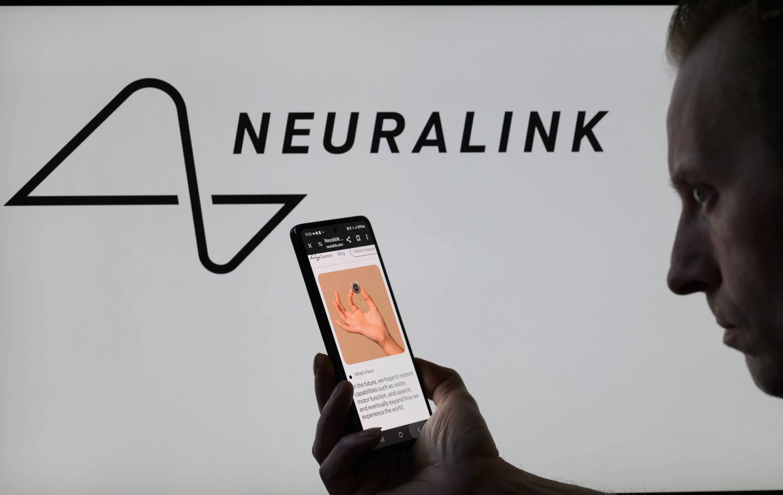 Second Patient Receives Neuralink Brain Chip Implant